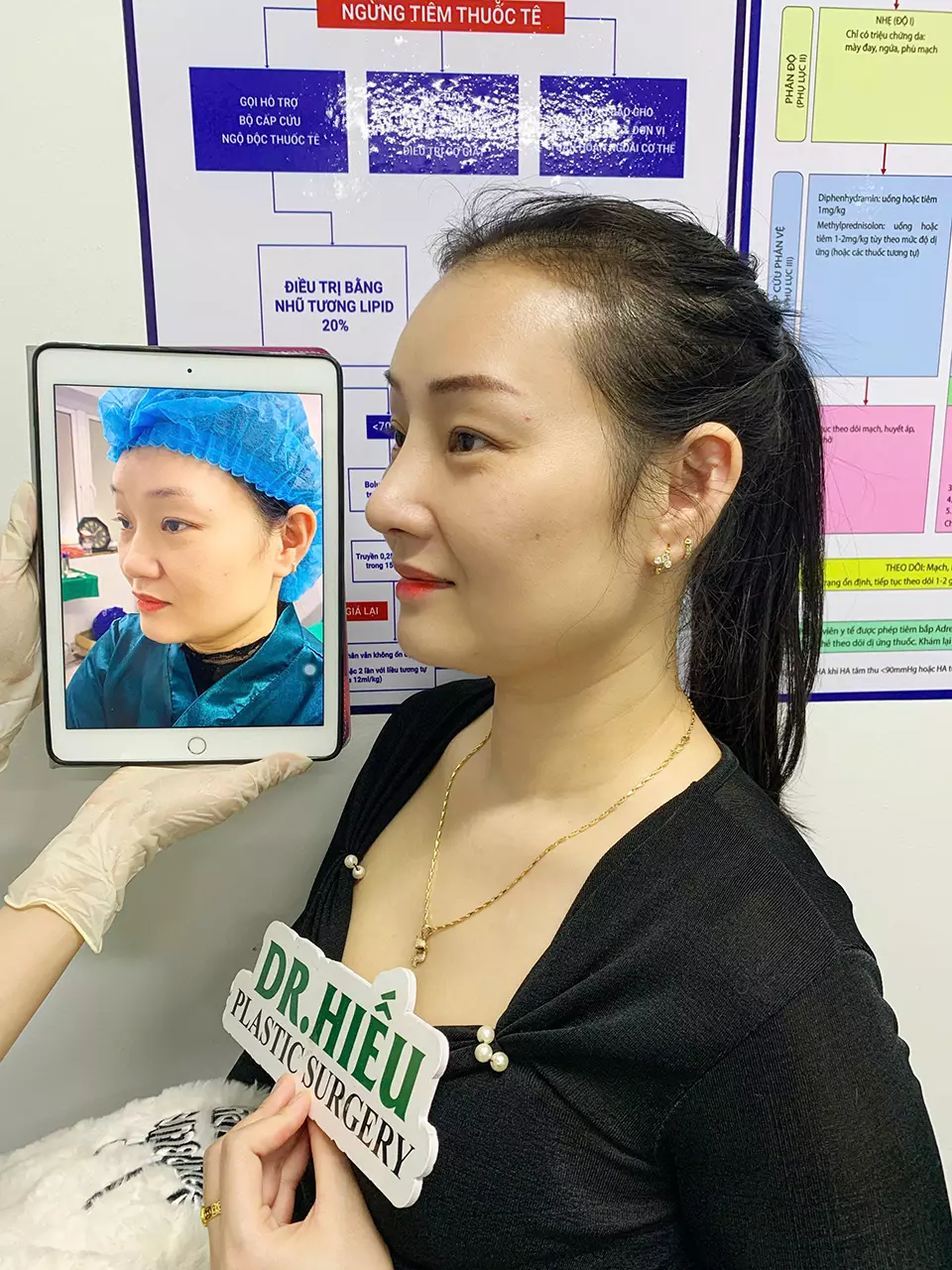 Hình ảnh thực tế nâng mũi (9)