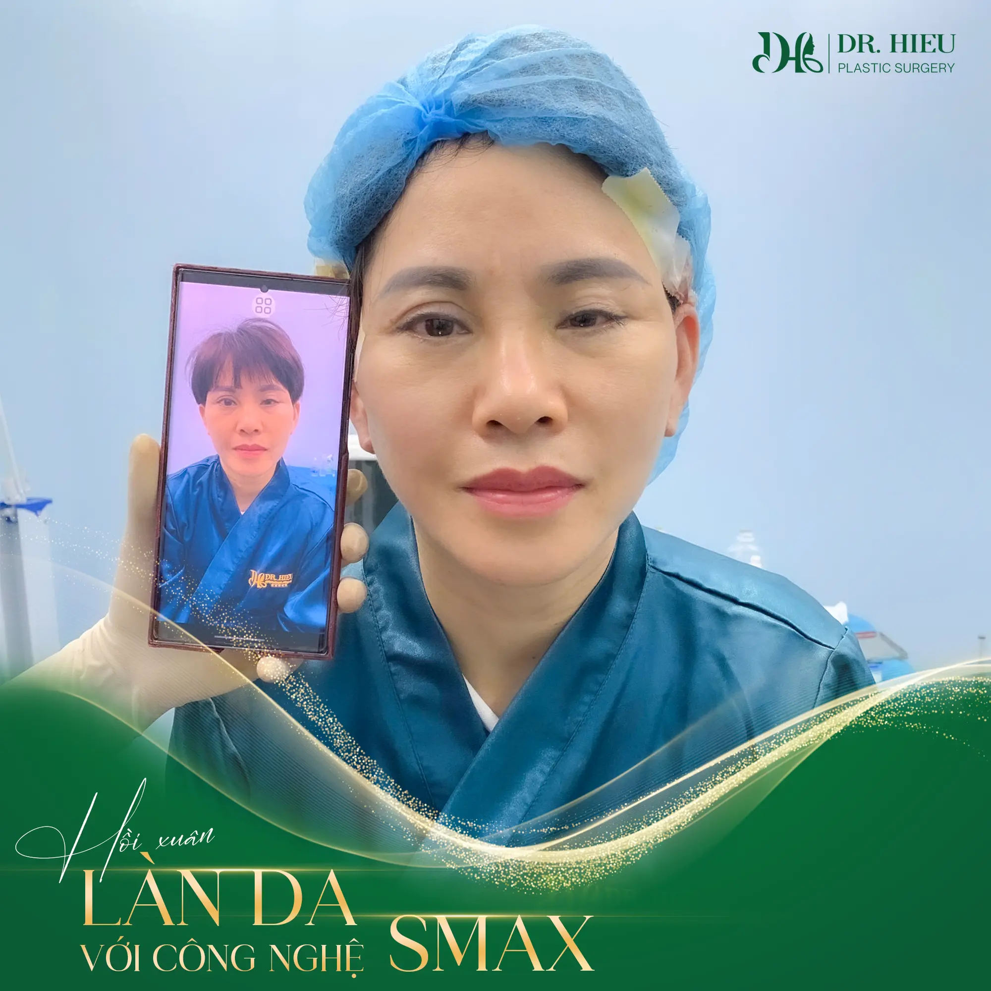 Hồi xuân làn da với công nghệ Smax (3)